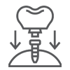 Dental_Implants